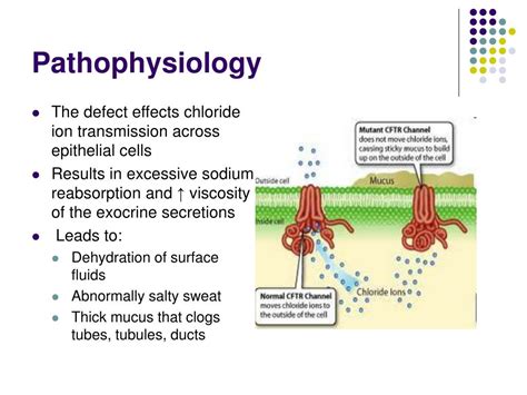 PPT - Cystic Fibrosis PowerPoint Presentation, free download - ID:1402144