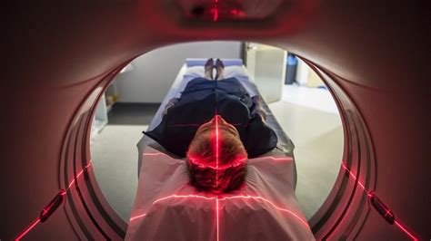 Radiation from CT Scans Could Minimally Increase Cancer Risk