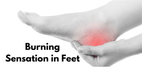 Burning Sensation in Feet: Causes, Treatment and Home Remedies - VIMS