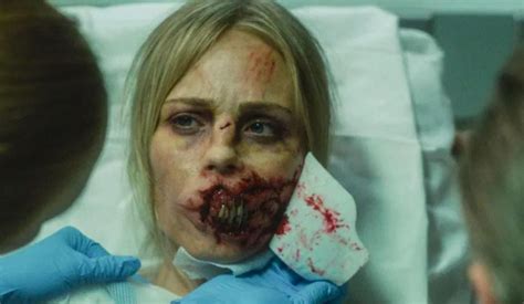 'Rabid' Trailer: Remake Of David Cronenberg's Horror Film Looks Pretty Disturbing