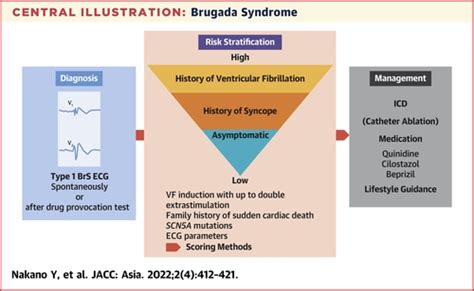 Brugada Syndrome as a Major Cause of Sudden Cardiac Death in Asians ...