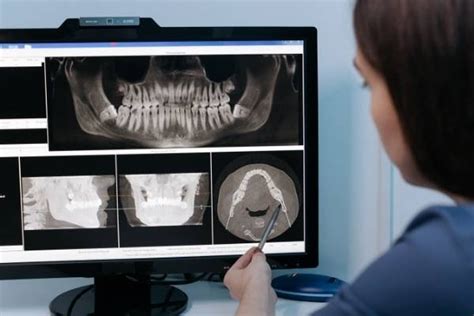 Importance of Oral and Maxillofacial Radiology in Dentistry - Smart ...