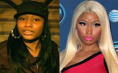 Nicki Minaj Nose Job Plastic Surgery Before And After Photos