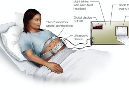 Intapartum Fetal Surveillance Flashcards | Quizlet