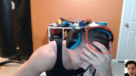 Unedited his headset really put a dent in his skull : r/loltyler1