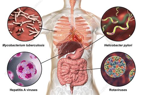 Bacteria that cause human infections, illustration - Stock Image - F023/9653 - Science Photo Library