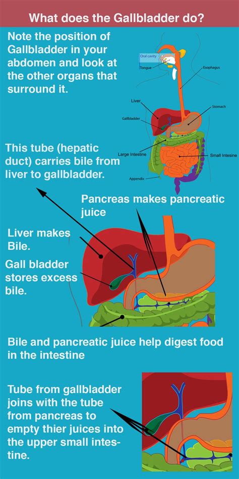 21 best Symptoms and Diagnosis Project images on Pinterest | Infographic, Infographics and ...