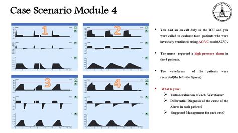 3.1a Mechanical ventilation Waveform Interpretation(Case Scenario) - YouTube