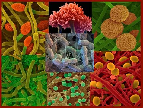 Image result for microbes in soil | Soil microorganisms, Microorganisms, Soil