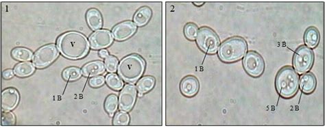 Yeast Under Microscope Labeled