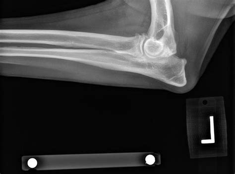 elbow dysplasia – A Veterinarian's Perspective