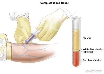 Blood Tests - Physiopedia