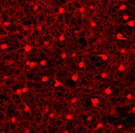 Horizontal cells – Retinal Microscopy