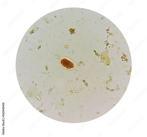 Stool parasites examination test for parasites or eggs in human stool ...