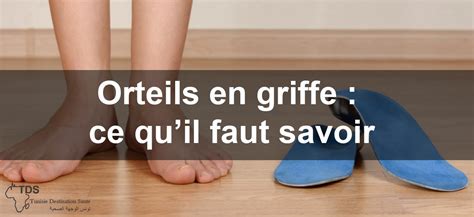 Orteils en griffe : Causes, symptômes et traitements