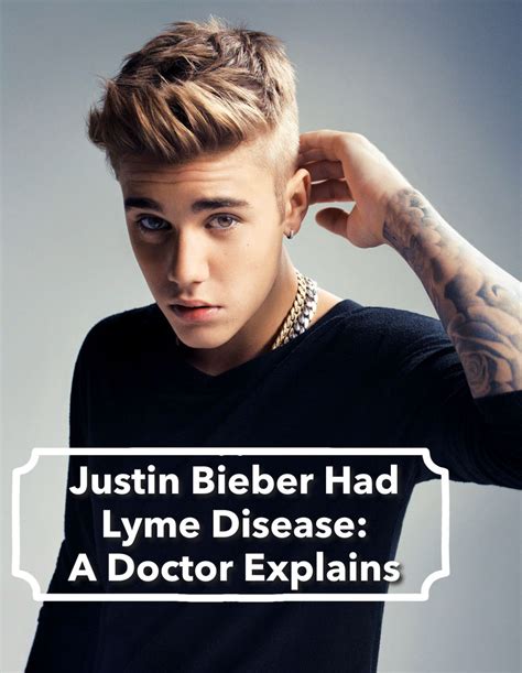 Justin Bieber Had Lyme Disease: A Doctor Explains | Lyme disease ...