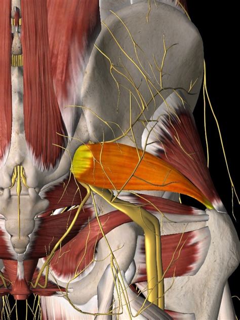 Piriformis Syndrome Specialist in Tampa, Florida — TampaPainMD