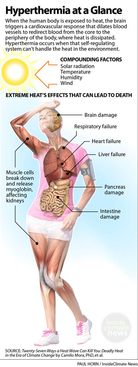 Hyperthermia at a Glance - Inside Climate News