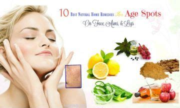 10 Best Natural Home Remedies For Age Spots On Face, Arms, Legs