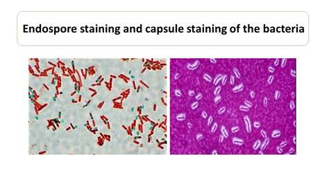 Spore Stain