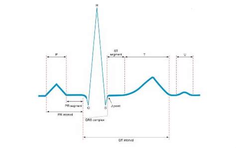 Cardiac Arrythmia Webquest > Process > ECG Interpretation > Start