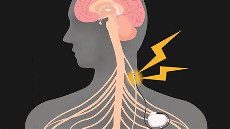 How is Tinnitus Diagnosis? Symptoms & Risk Factors - Etinnitus Treatment