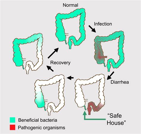 The Appendix as a Safe House – William Parker Lab