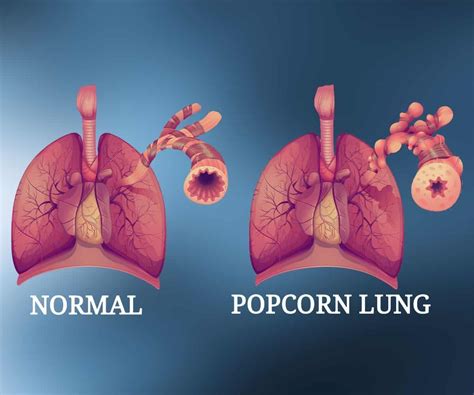 Electronic Cigarette Health Risks