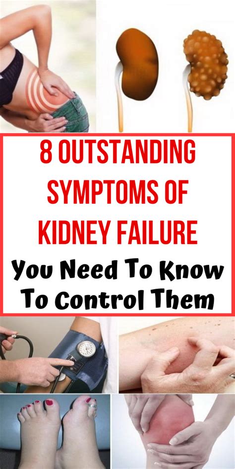 8 Outstanding Symptoms Of Kidney Failure You Need To Know To Control Them