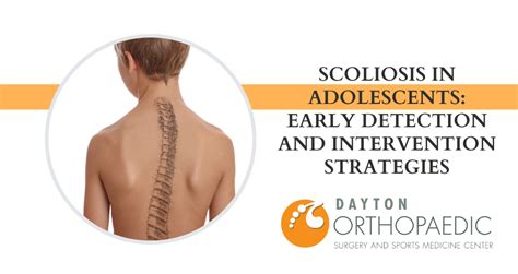 Scoliosis in Adolescents