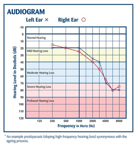 medical science - Does the range of sound we can hear decrease as we age? - Skeptics Stack Exchange