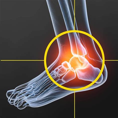 Ankle Arthroscopy - Brighton Foot and Ankle