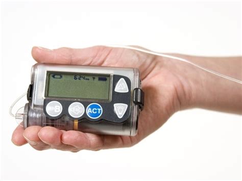 Diabetes Treatment: Pros and Cons of Insulin Pumps | Healthy Living