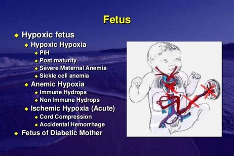 Color doppler in fetal hypoxia