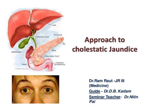 Approach to cholestatic jaundice