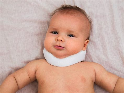 Torticollis - Symptoms, Causes, Types And Other Risk Factors