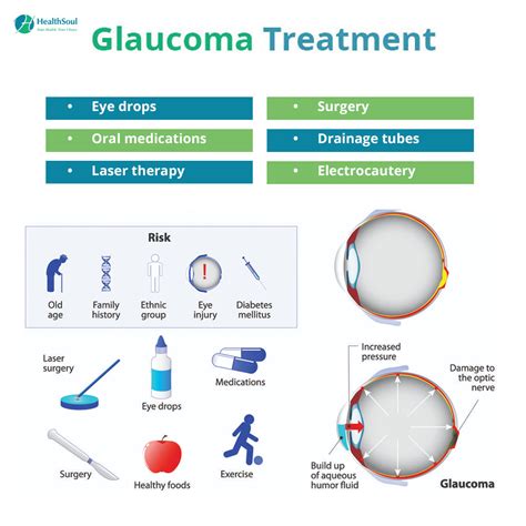 Glaucoma: Symptoms, Diagnosis and Treatment – Healthsoul