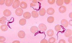 Trypanosoma brucei complex - Epidemiology, Transmission, Lab Diagnosis, Treatment, Control