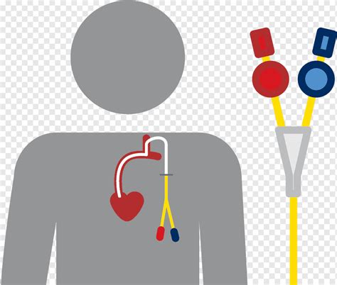 Fistula Catheter