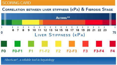 Alcohol Liver Damage | FibroScan