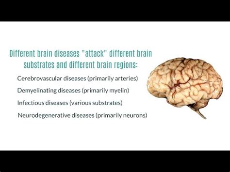 Neurodegenerative Diseases of the Brain - YouTube