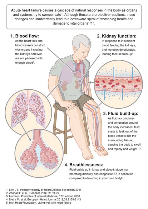 22 best Congestive Heart Failure Signs and Symptoms images on Pinterest | Heart failure, Signs ...