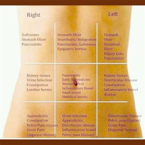 Abdominal Quadrants Chart