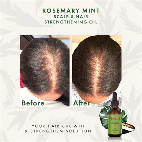 Mielle Organics Rosemary Mint Scalp & Hair Strengthening Oil 2oz — Kiyo Beauty