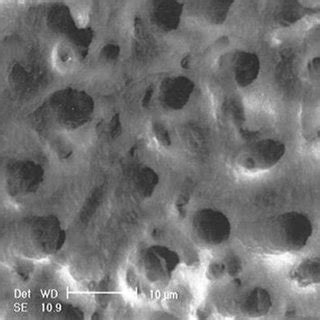 SEM micrograph of exposed dentinal tubules in the laser group. ×1500 | Download Scientific Diagram