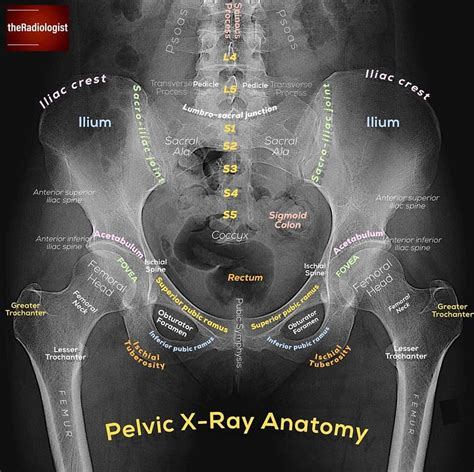 Pelvic X-ray Anatomy #Ashiry - Radiology Students Of A.M.S