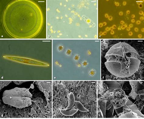 Microscope images of phytoplankton taxa from samples collected in the... | Download Scientific ...