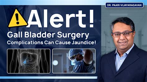 Alert! Gall Bladder Surgery Complications Can Cause Jaundice! - YouTube