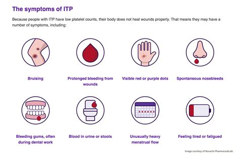 Lupus and Thrombocytopenia | LaptrinhX / News