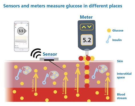 Continuous Glucose Monitoring (CGM) - The Glucose Never Lies